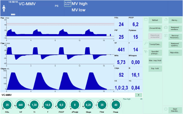 Digitalizace obrazovky ventilátoru